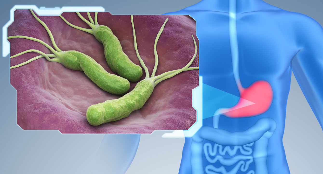 helicobacter pylori testing
